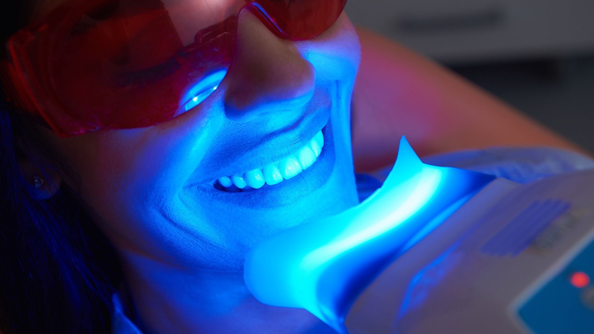 Dental teeth whitening procedure using blue UV light